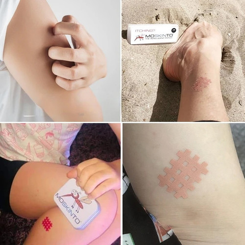 Miếng dán giảm ngứa và sưng do muỗi và côn trùng cực hiệu quả cho trẻ - Moskinto (Đức)