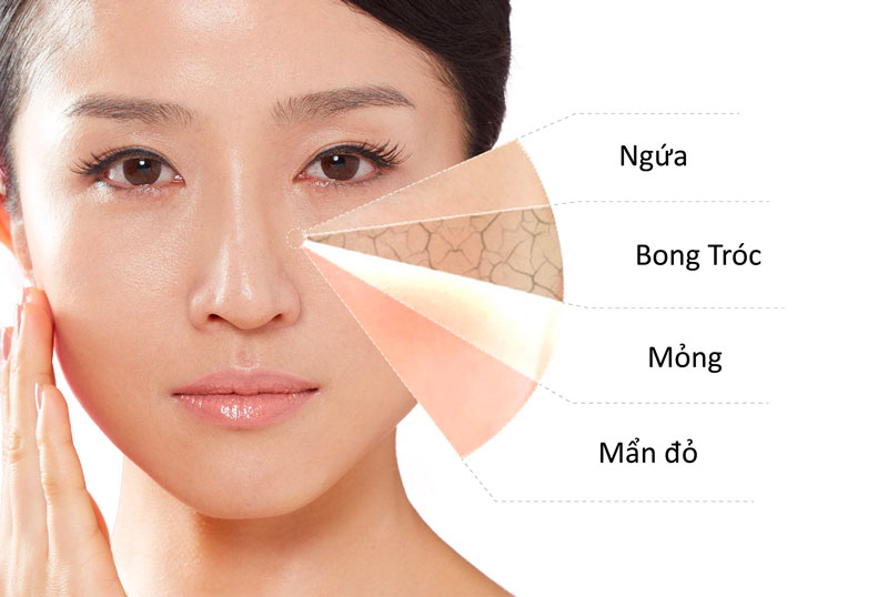 Hướng dẫn làm sạch cho da nhạy cảm