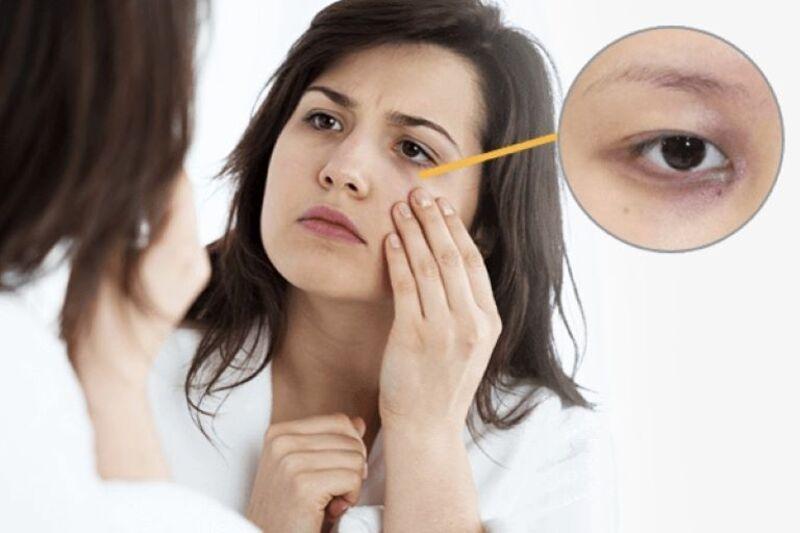 Những dấu hiệu cho thấy làn da bị stress