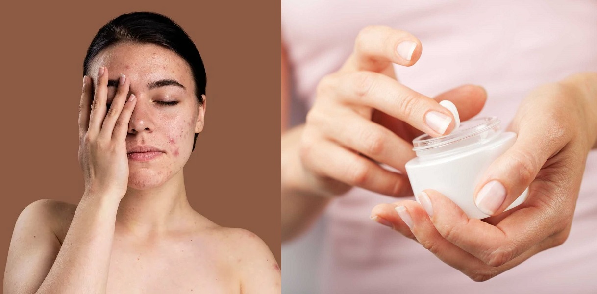 Có nên sử dụng mỹ phẩm cận date và gần hết hạn sử dụng?