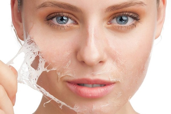 Peel da trị thâm là gì? Hiệu quả của peel da