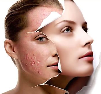 Top 4 kem dưỡng phục hồi da sau peel tốt nhất hiện nay