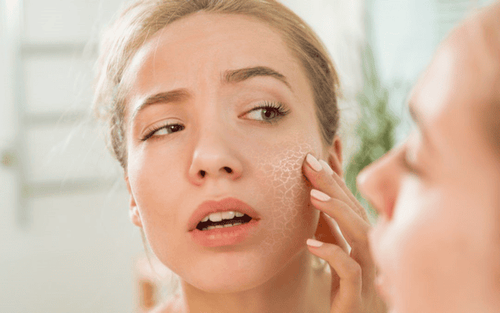 Mẹo tẩy da chết để giúp da sạch mụn