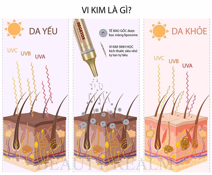 Vi kim sinh học là gì? Tất cả những điều cần biết về vi kim sinh học.
