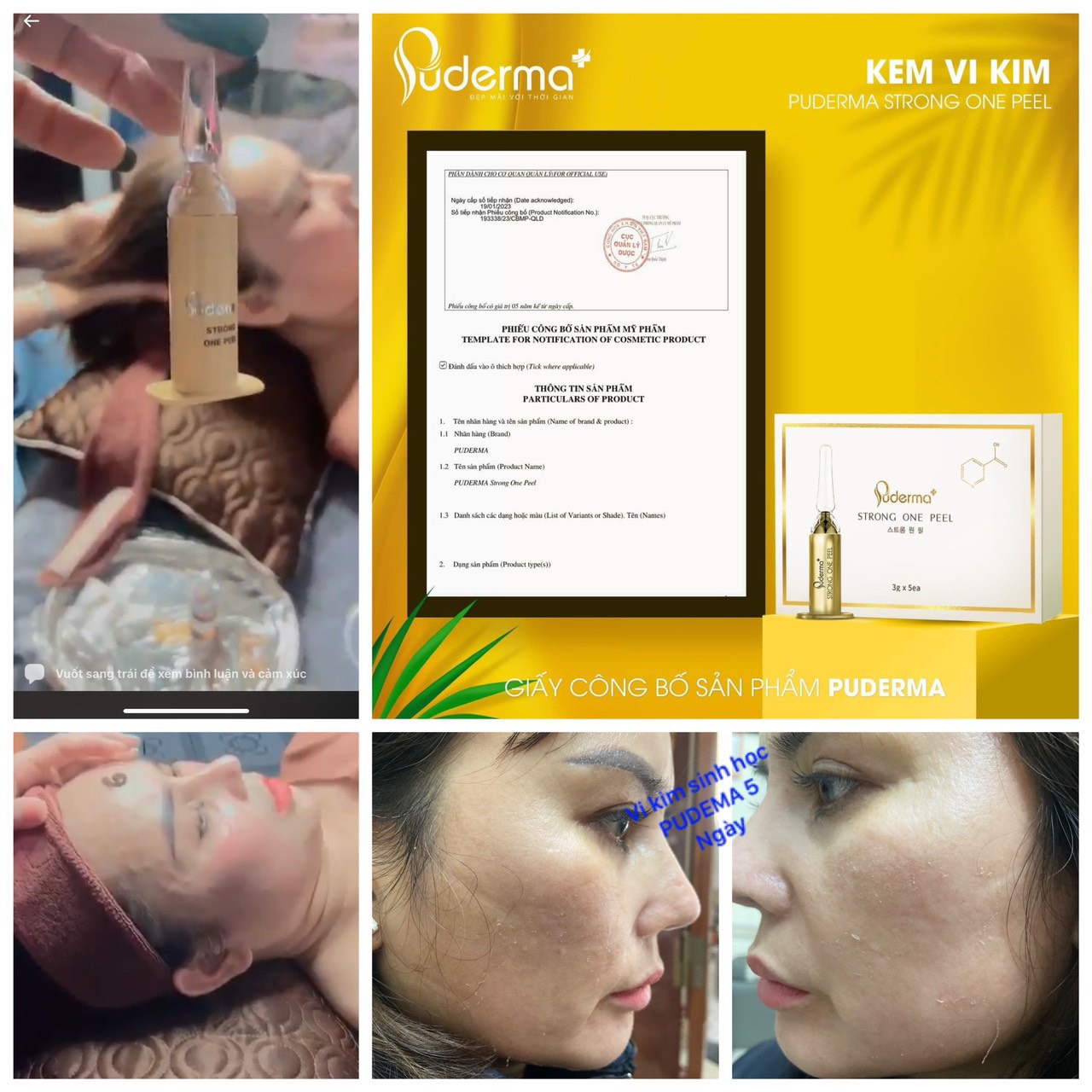 Vi Kim Sinh Học Puderma và những kiến thức cần biết.