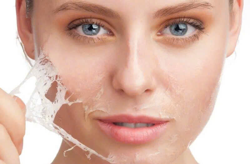 Da nhạy cảm có nên peel da không? Những điều cần lưu ý