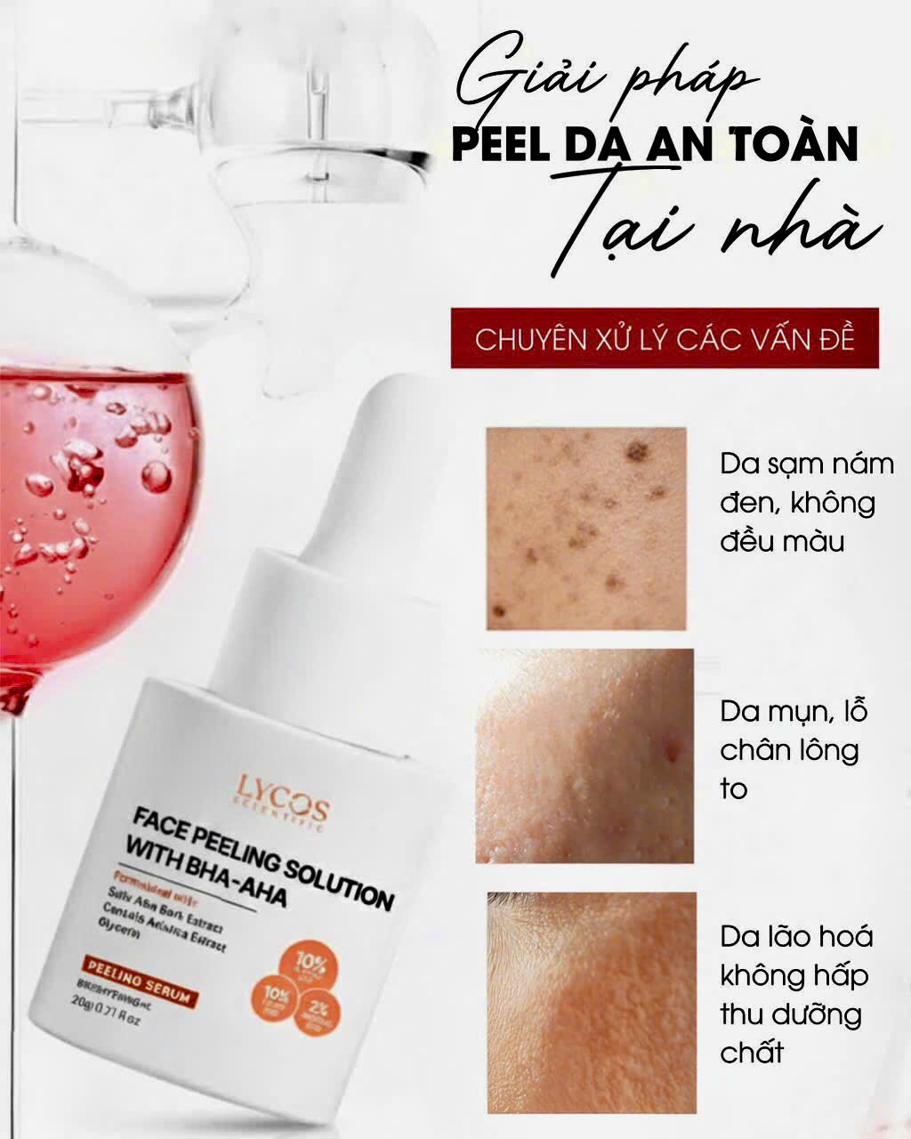 Peel da an toàn tại nhà – Giải pháp giúp da khỏe và đều màu hơn