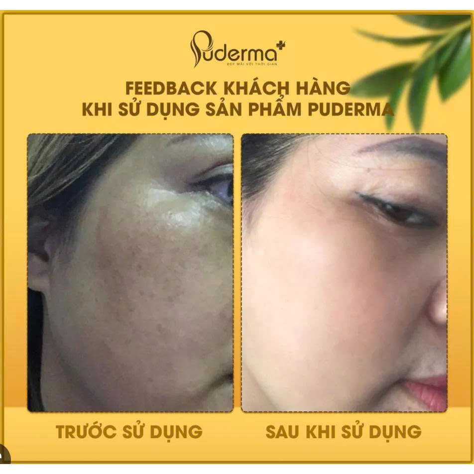 Tinh Chất Dưỡng Da Puderma Intensive Serum 60ml – Cấp ẩm sâu, hỗ trợ tái tạo & làm dịu da