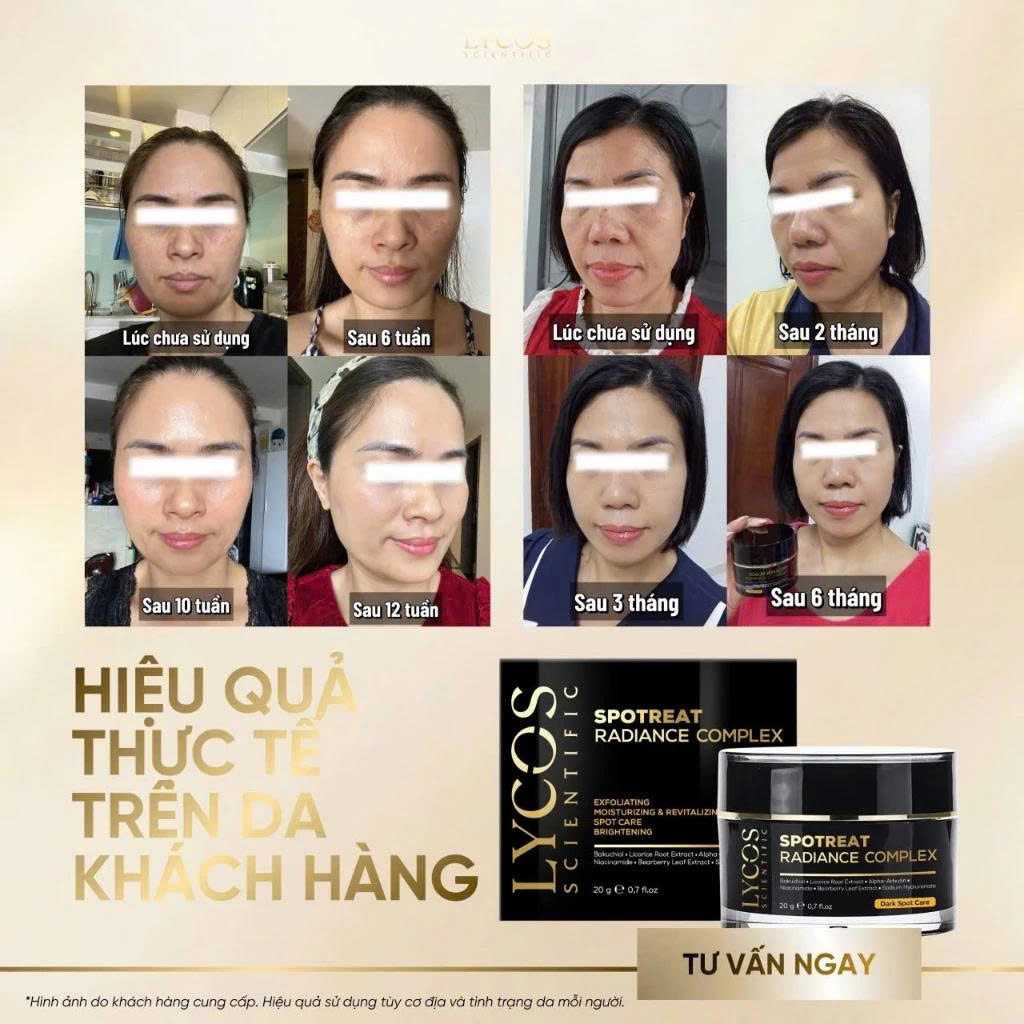 Kem Nám Đêm Spotreat Radiance Complex LYCOS – Giảm Thâm Nám, Dưỡng Trắng, Cải Thiện Da Không Đều Màu
