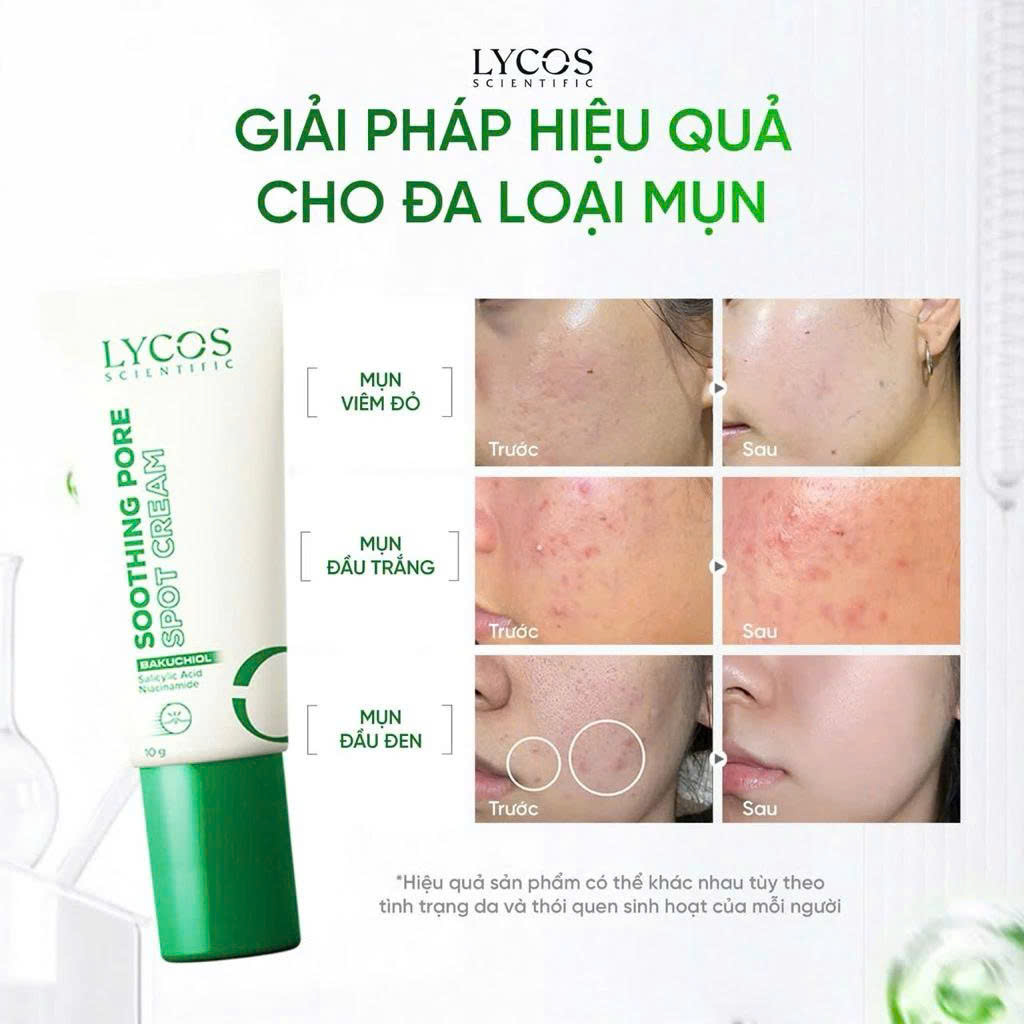 Kem Chấm Mụn Lycos Soothing Pore Spot Cream 10g – Giảm Mụn, Ngừa Thâm, Nhanh Gom Cồi Mụn.