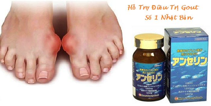 Viên Uống Điều Trị Gout 240 Viên