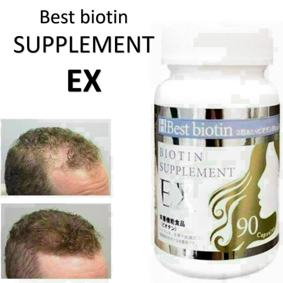 Viên Uống Kích Thích Mọc Tóc Best Biotin Supplement Ex 90V