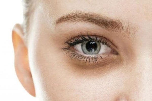 PHẨU THUẬT BỌNG MỠ MẮT PHẨU THUẬT BỌNG MỠ MẮT