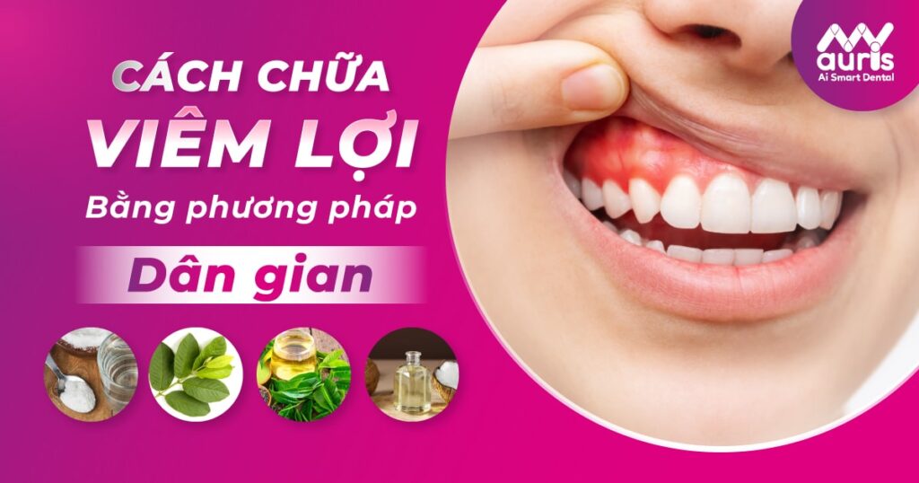 Liệt kê 10 cách chữa viêm lợi tại nhà bằng các mẹo hay từ dân gian
