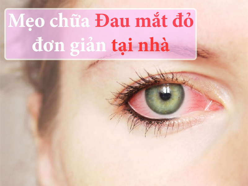 8 phương pháp dân gian chữa đau mắt đỏ tại nhà hiệu quả nhanh nhất