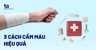 3 CÁCH CẦM MÁU NHANH CHÓNG TẠI NHÀ HIỆU QUẢ KỊP THỜI