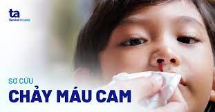 CÁCH SƠ CỨU CHẢY MÁU CAM (MŨI) NHANH CHÓNG, HIỆU QUẢ, AN TOÀN