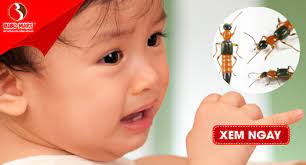 11 mẹo đơn giản không độc hại giúp mẹ đuổi kiến ra khỏi nhà