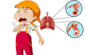 Những mẹo dân gian chữa viêm phổi cho trẻ có thể bạn chưa biết