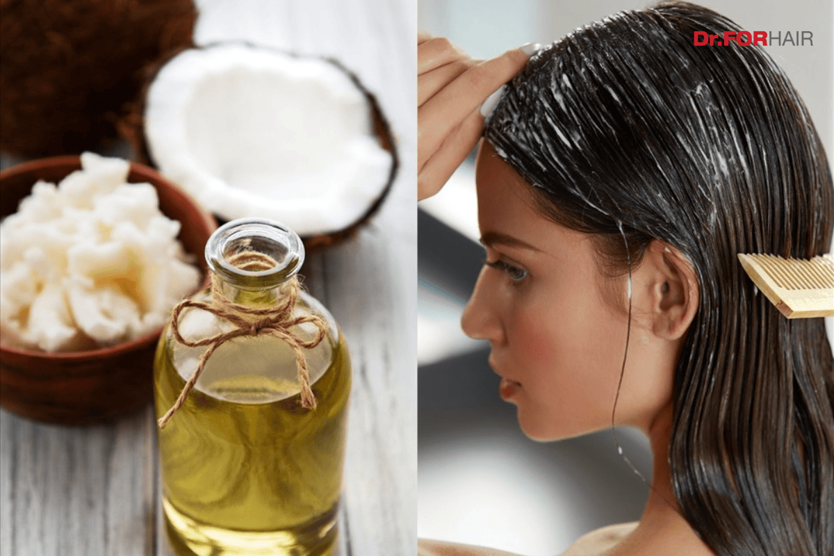 7 cách trị rụng tóc tại nhà đơn giản và hiệu quả