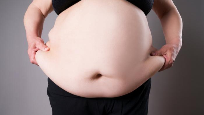 Nên làm gì khi được chẩn đoán béo phì?