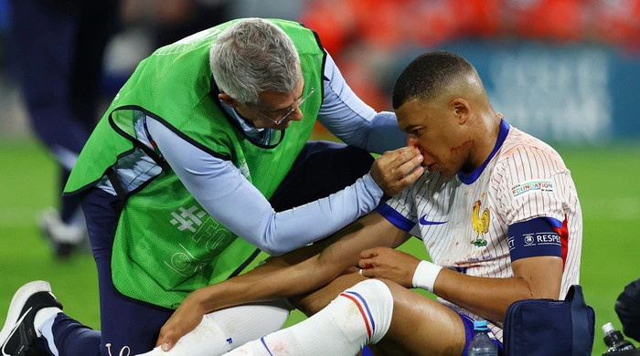 Mbappe bị gãy mũi phải phẫu thuật khẩn cấp, có thể bỏ lỡ toàn bộ Euro 2024