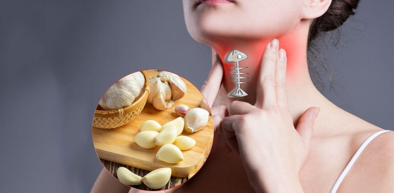 5 cách chữa mắc cổ xương cá tại nhà an toàn, nhanh chóng