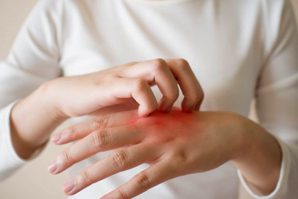 Những dấu hiệu trên da cảnh báo gan nhiễm mỡ