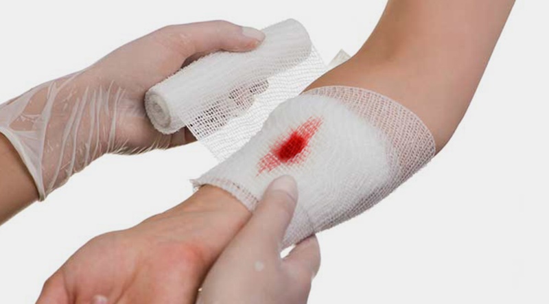 Chăm vết thương hở nên kiêng thực phẩm nào?