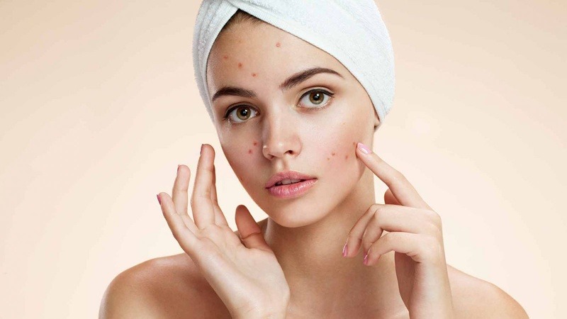 Ăn dưa lưới không gây nổi mụn mà ngược lại còn rất tốt cho da