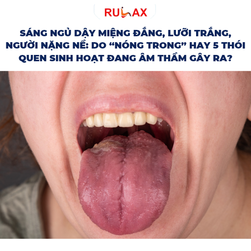 Sáng ngủ dậy miệng đắng, lưỡi trắng, người nặng nề: Do “nóng trong” hay 5 thói quen sinh hoạt đang âm thầm gây ra?