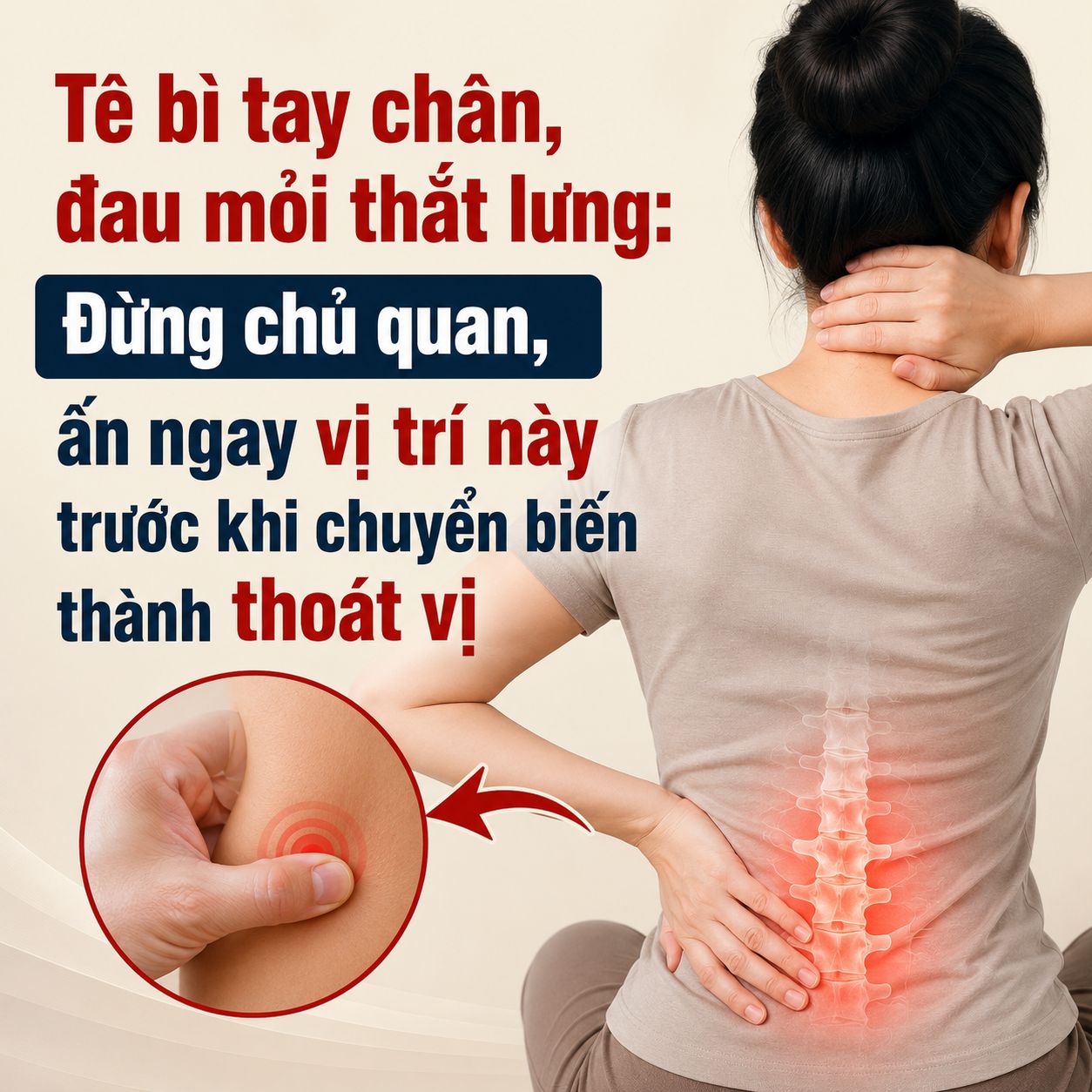 Tê bì tay chân, đau mỏi thắt lưng: Đừng chủ quan, ấn ngay vị trí này trước khi chuyển biến thành thoát vị