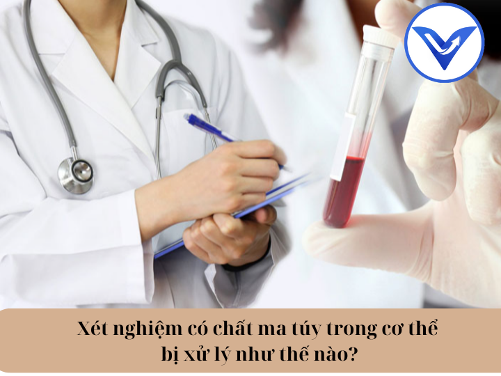 Xét nghiệm có chất ma túy trong cơ thể bị xử lý như thế nào?