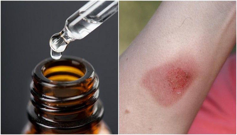 Sai lầm cần tránh khi sử dụng tinh dầu