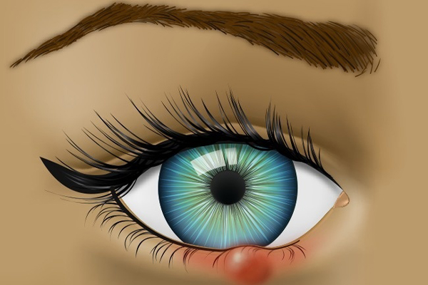 5 DẤU HIỆU CỦA ĐÔI MẮT GẶP VẤN ĐỀ NGHIÊM TRỌNG, BẠN NÊN THAM KHẢO NGAY.