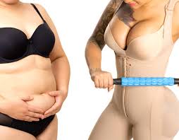Những điều chị em cần phải biết sau hút mỡ