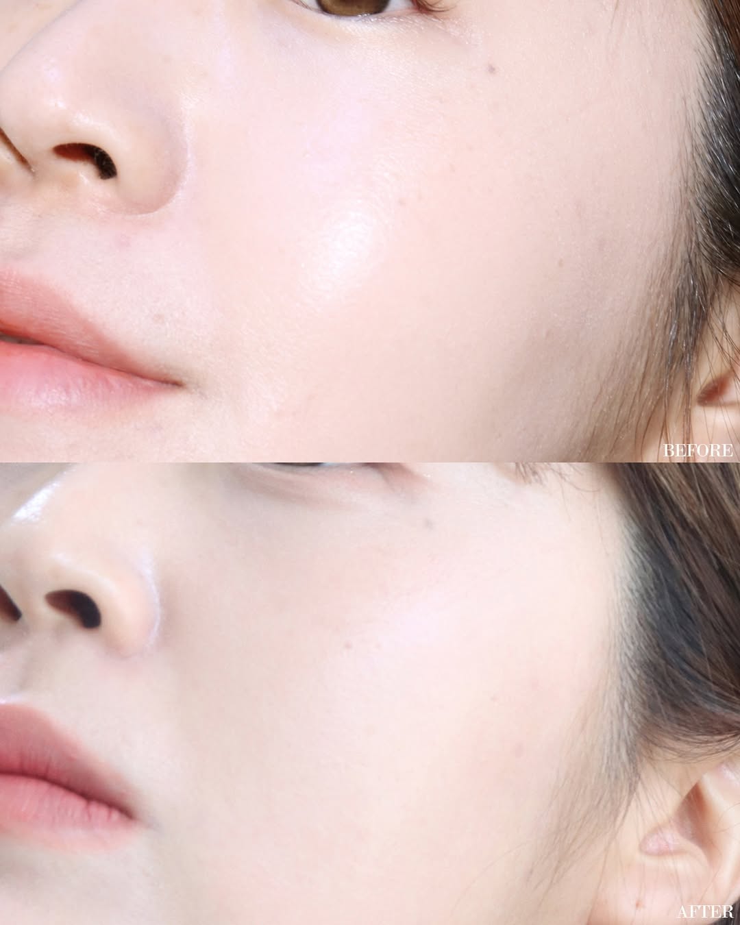 Givenchy Before After