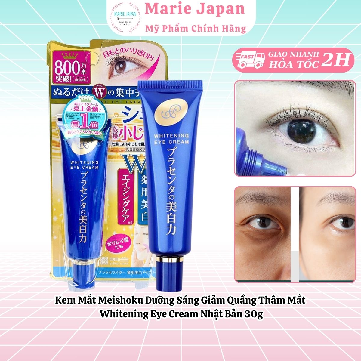 Kem Mắt Meishoku Dưỡng Sáng Giảm Quầng Thâm Mắt Whitening Eye Cream Nhật Bản 30g