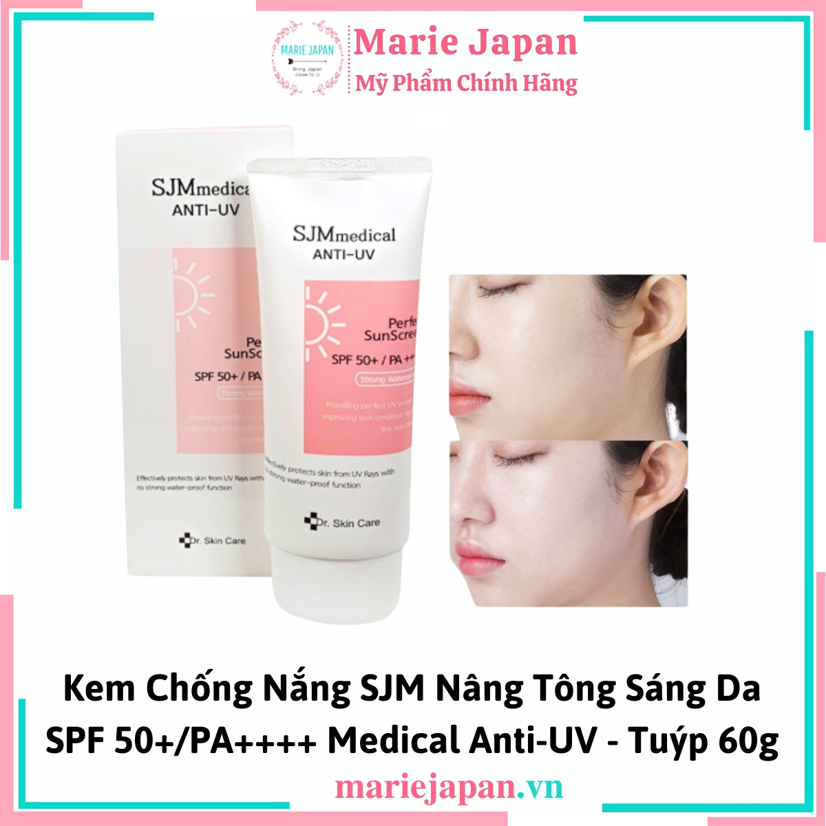Kem Chống Nắng SJMmedical Anti UV Perfect Sun Screen Tuýp 60g