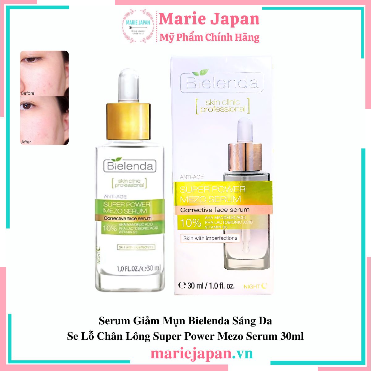 Serum Giảm Mụn Bielenda Sáng Da Se Lỗ Chân Lông Super Power Mezo Serum 30ml