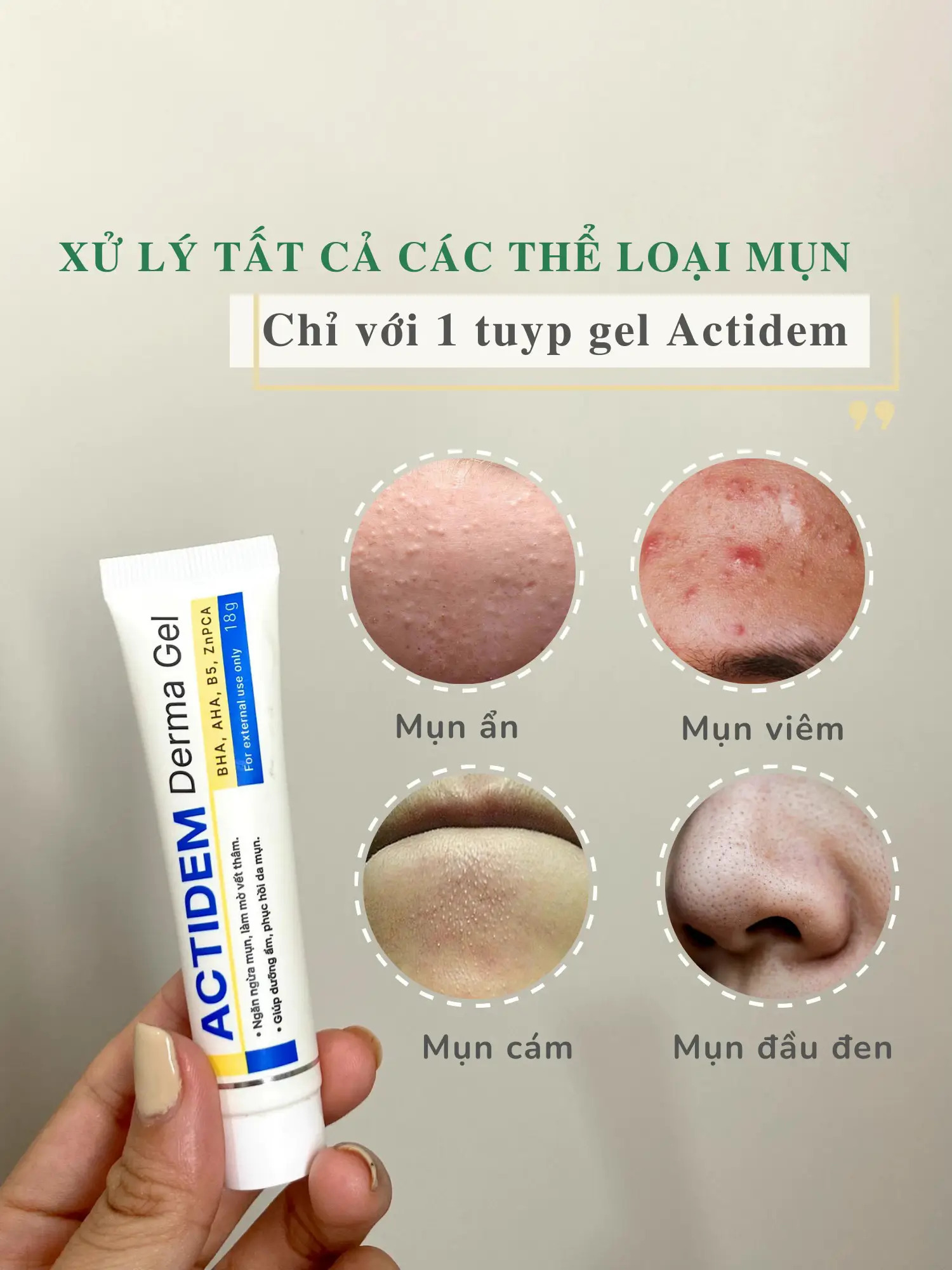 ACTIDEM DERMA GEL CÓ THỂ BÔI TOÀN MẶT GIÚP DA MỊN MÀNG SÁNG KHỎE