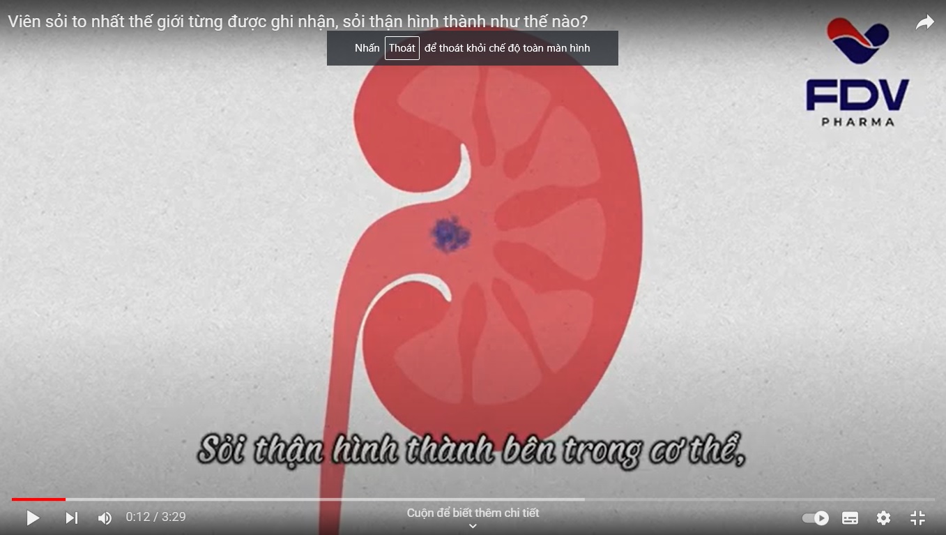 VIÊN SỎI TO NHẤT THẾ GIỚI TỪNG ĐƯỢC GI NHẬN