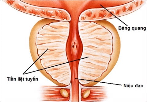 VIÊM TUYẾN TIỀN LIỆT CÓ TỰ KHỎI KHÔNG?