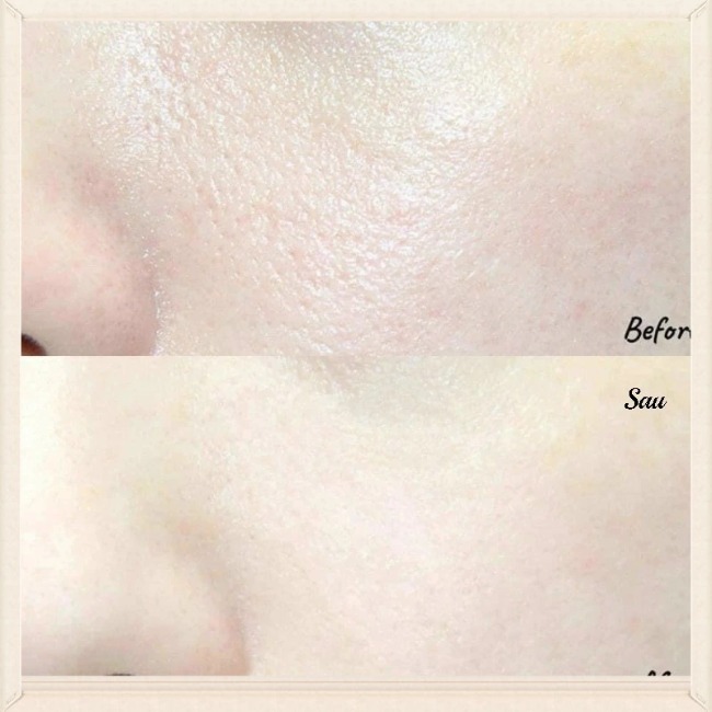 Serum Dưỡng Mềm Da, Giảm Sưng, Ngăn Ngừa Mụn The Ordinary Niacinamide 10% + Zinc 1% 30ml