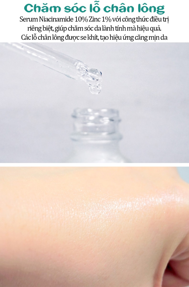 Serum Dưỡng Mềm Da, Giảm Sưng, Ngăn Ngừa Mụn The Ordinary Niacinamide 10% + Zinc 1% 30ml