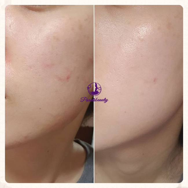 Kem Chống Nắng Dưỡng Ẩm Skin1004 SPF50+ PA++ Dành Cho Da Nhạy Cảm 50ml