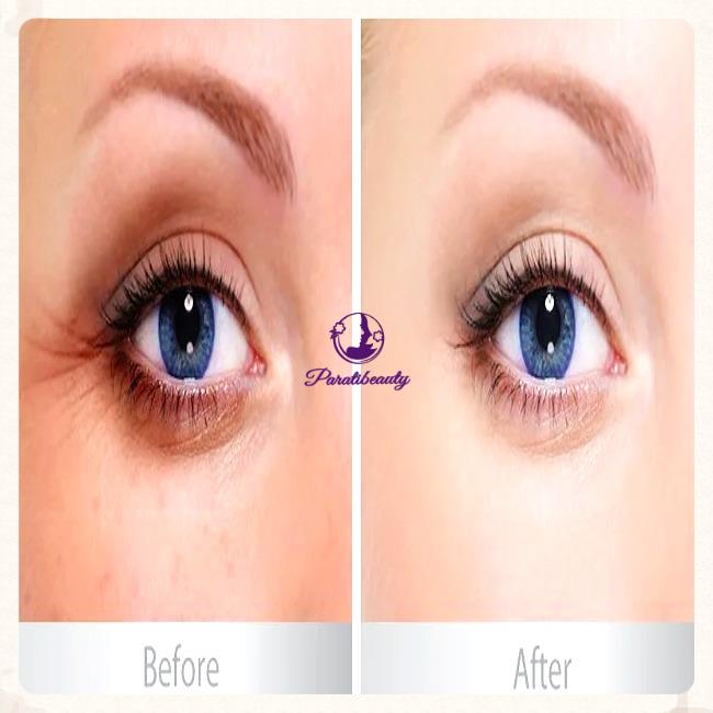 Serum Dưỡng Vùng Da Mắt Balance Active Formula Gold Collagen Rejuvenating eye 15ml (Date T5/2025)