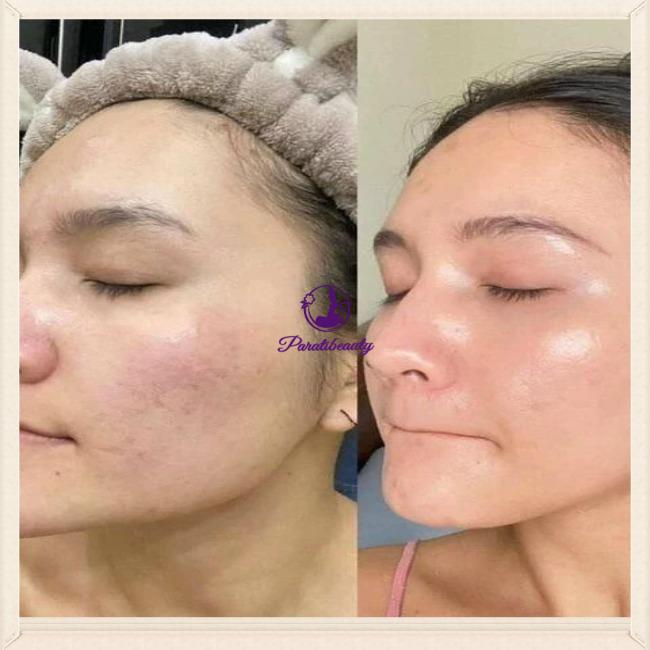 Kem Dưỡng Da Trẻ Hóa, Ngừa Mụn Obagi 360 Retinol 0.5