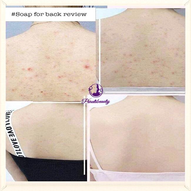 Xà phòng tắm giảm mụn lưng For Back Nhật Bản 135g