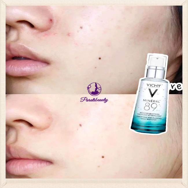 Serum Khoáng Phục Hồi Chuyên Sâu  Thần Thánh Vichy Mineral 89 Pháp 50ml